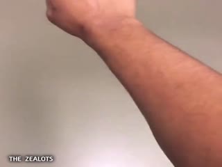 Парень набрел в больнице на интересный аппарат и просмотрел свои вены на руке