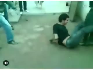 Поломал руку