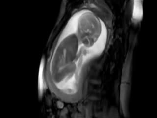 Неужели я был таким же?!