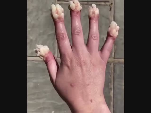 Это зубы или ногти?
