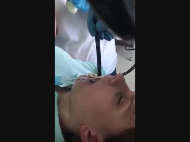 Врачи извлекли из женщины змею