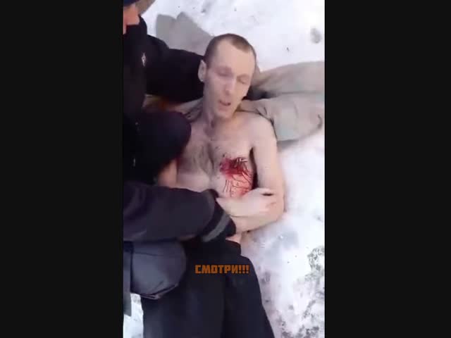 В Новосибирской области наркоман вонзил себе нож по рукоятку в грудь
