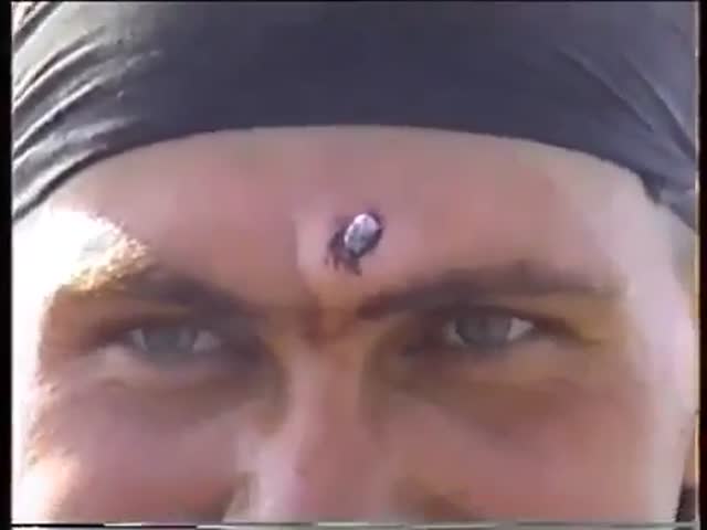 У русского солдата застряла пуля во лбу!